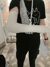Ушиб всей бабки. (01.04.2025)
